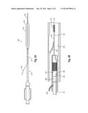 HYPOTUBE WITH ENHANCED STRENGTH AND DUCTILITY diagram and image