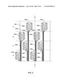 RENAL DENERVATION BALLOON CATHETER WITH RIDE ALONG ELECTRODE SUPPORT diagram and image