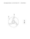 RENAL DENERVATION BALLOON CATHETER WITH RIDE ALONG ELECTRODE SUPPORT diagram and image