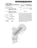 BONE FIXATION DEVICE diagram and image