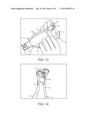 MINIMALLY INVASIVE DEVICE FOR SURGICAL OPERATIONS diagram and image