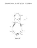 MINIMALLY INVASIVE DEVICE FOR SURGICAL OPERATIONS diagram and image