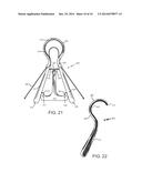 MINIMALLY INVASIVE DEVICE FOR SURGICAL OPERATIONS diagram and image