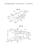 METHODS OF USING APPLICATOR INSTRUMENTS FOR SECURING PROSTHETIC DEVICES TO     TISSUE diagram and image