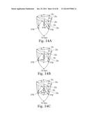 Percutaneous Valve Repair by Reshaping and Resizing Right Ventricle diagram and image