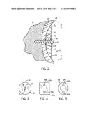 SOFT TISSUE ATTACHMENT DEVICE diagram and image