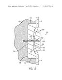 SOFT TISSUE ATTACHMENT DEVICE diagram and image