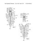 SUTURE ANCHOR AND ASSOCIATED SYSTEMS AND METHODS diagram and image