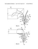 SUTURE ANCHOR AND ASSOCIATED SYSTEMS AND METHODS diagram and image