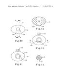 GROWTH DIRECTED VERTEBRAL FIXATION SYSTEM WITH DISTRACTIBLE CONNECTOR(S)     AND APICAL CONTROL diagram and image