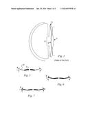 SMALL APERTURE (PINHOLE) INTRAOCULAR IMPLANT TO INCREASE DEPTH OF FOCUS diagram and image