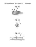 Method of Performing Anterior Cruciate Ligament Reconstruction Using     Biodegradable Interference Screw diagram and image