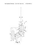 FEMORAL COMPONENT OF A KNEE PROSTHESIS HAVING AN ANGLED CEMENT POCKET diagram and image