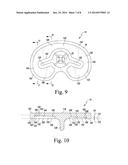 FEMORAL COMPONENT OF A KNEE PROSTHESIS HAVING AN ANGLED CEMENT POCKET diagram and image