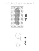 METHOD AND SYSTEM FOR DETERMINING TREATMENTS BY MODIFYING PATIENT-SPECIFIC     GEOMETRICAL MODELS diagram and image