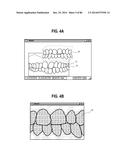 METHOD AND SYSTEM FOR INTEGRATED ORTHODONTIC TREATMENT PLANNING USING     UNIFIED WORKSTATION diagram and image