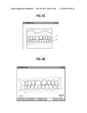 METHOD AND SYSTEM FOR INTEGRATED ORTHODONTIC TREATMENT PLANNING USING     UNIFIED WORKSTATION diagram and image