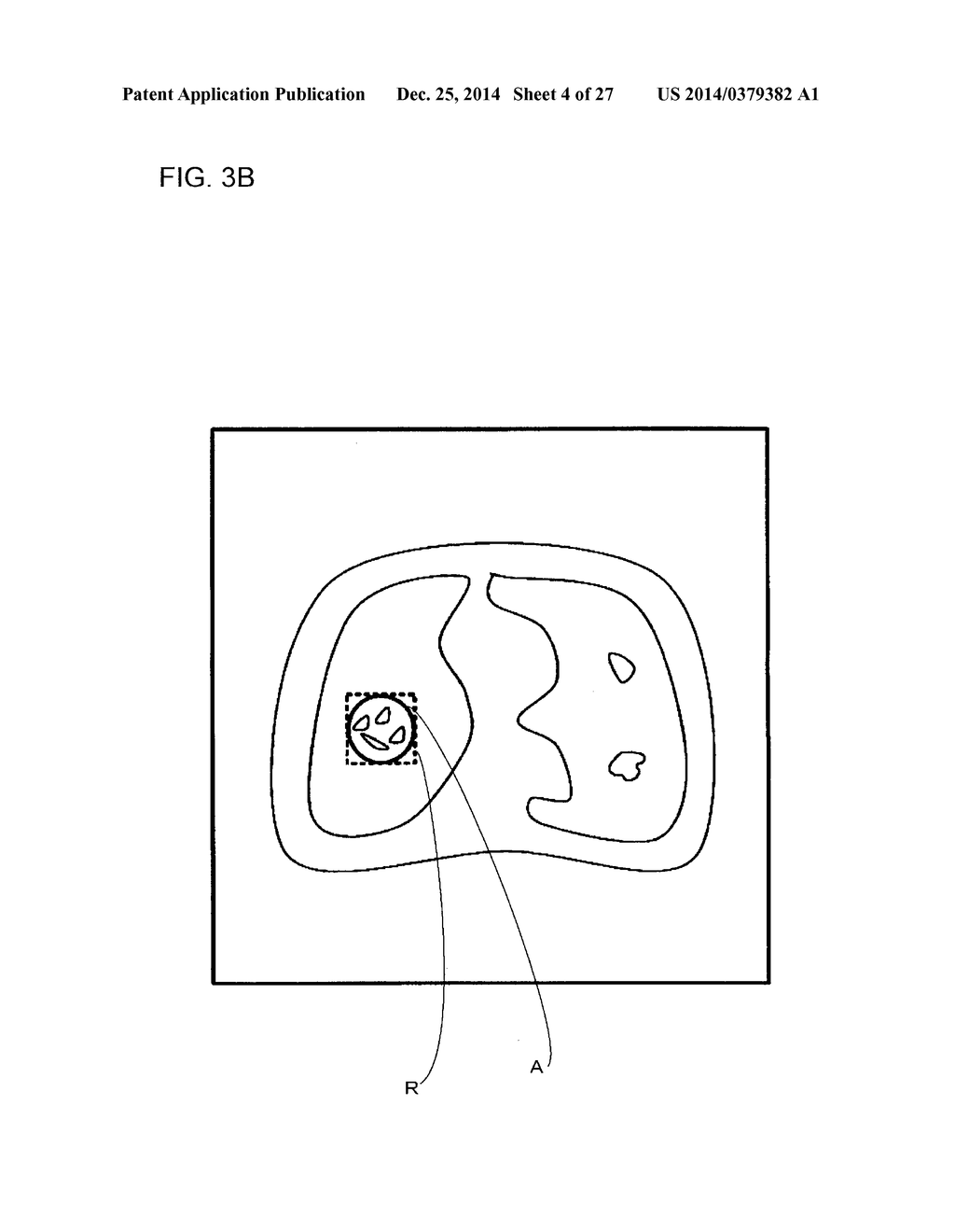 REPORT GENERATION SUPPORT APPARATUS AND REPORT READING APPARATUS - diagram, schematic, and image 05