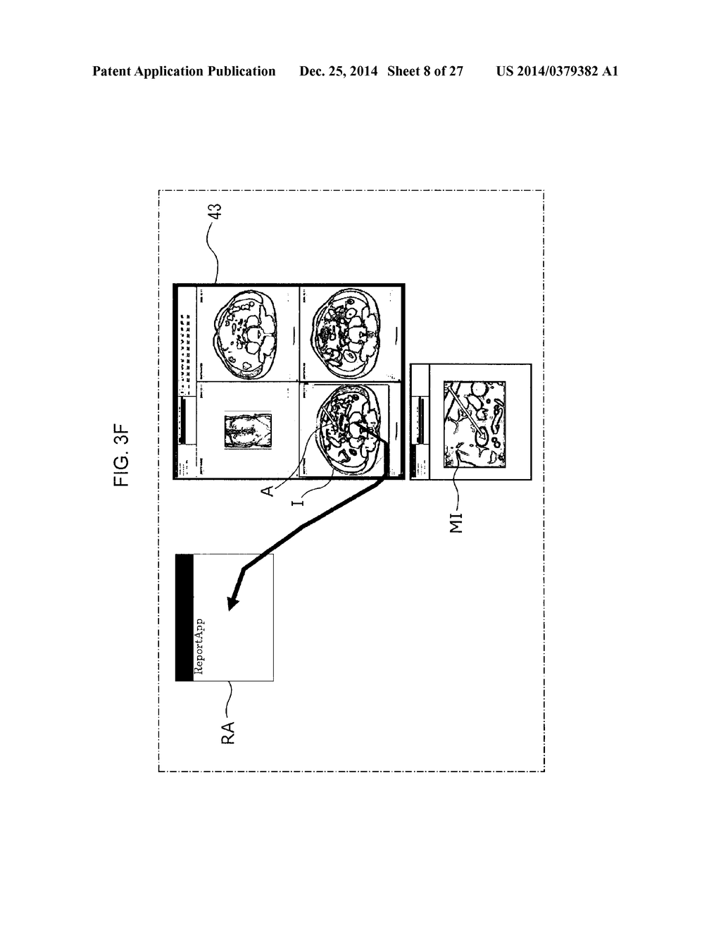 REPORT GENERATION SUPPORT APPARATUS AND REPORT READING APPARATUS - diagram, schematic, and image 09