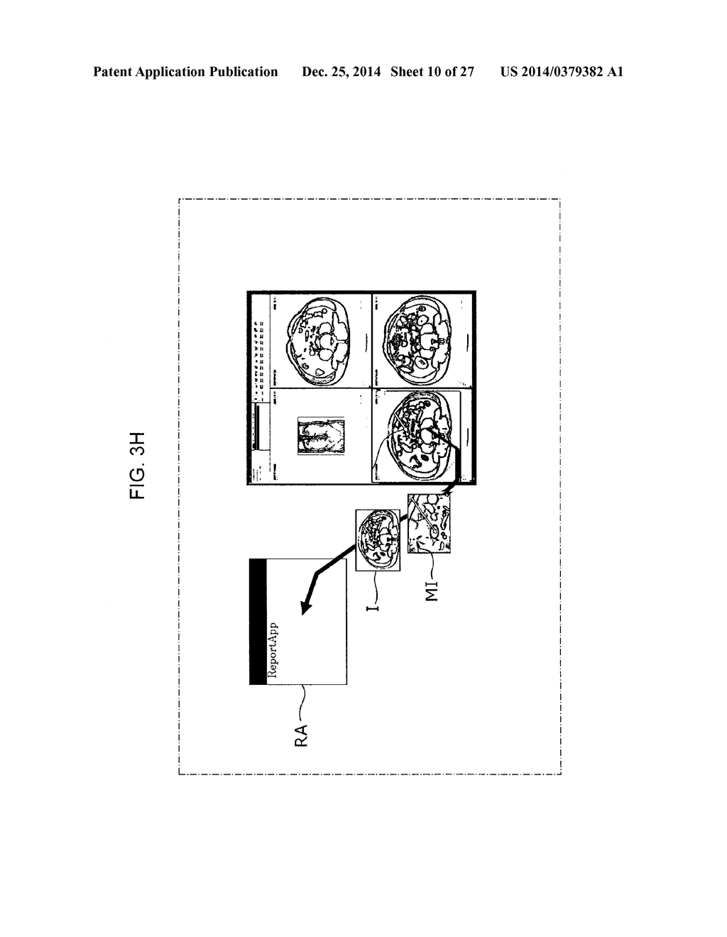 REPORT GENERATION SUPPORT APPARATUS AND REPORT READING APPARATUS - diagram, schematic, and image 11