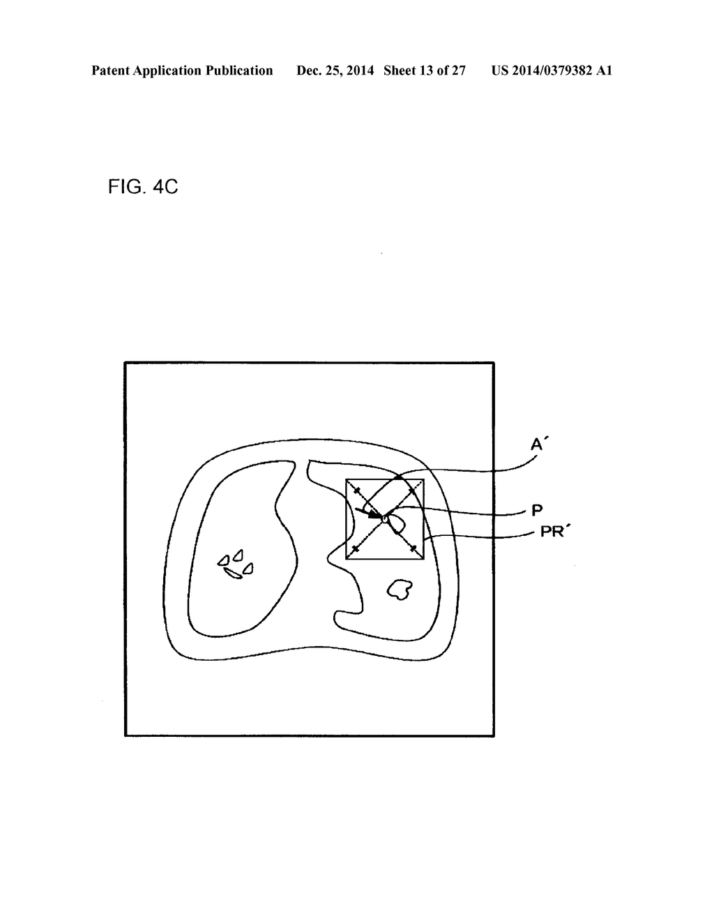 REPORT GENERATION SUPPORT APPARATUS AND REPORT READING APPARATUS - diagram, schematic, and image 14