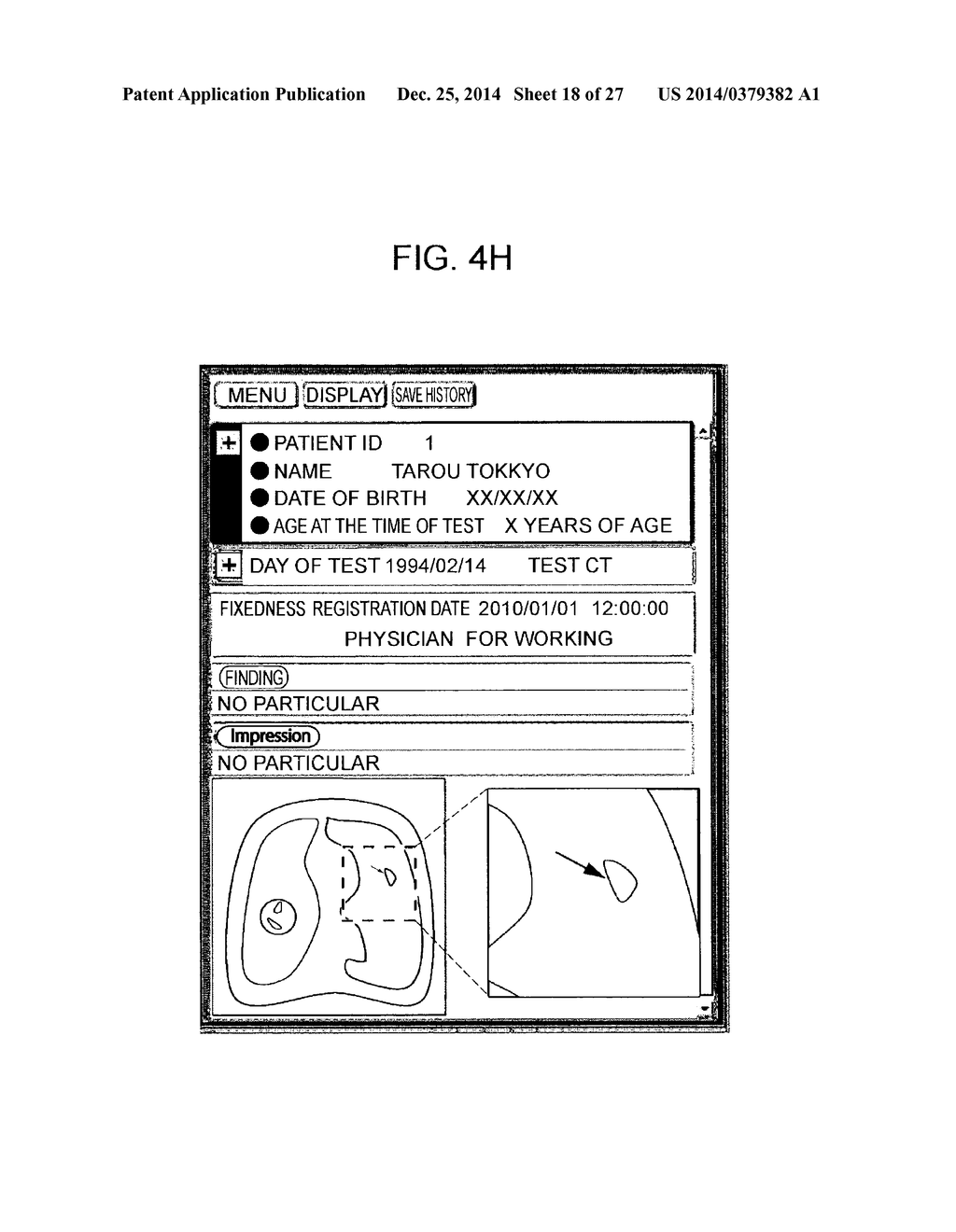 REPORT GENERATION SUPPORT APPARATUS AND REPORT READING APPARATUS - diagram, schematic, and image 19