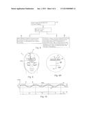 IMPLANTABLE DEVICE FOR THE TREATMENT OF HYDROCEPHALUS SYNDROME AND THE     CORRESPONDING METHOD diagram and image