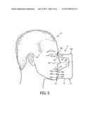 PATIENT INTERFACE SIZING GAUGE diagram and image