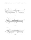 METHODS FOR TYING, CLEANING AND RE-CEMENTING MASONRY USING PORT ANCHORS diagram and image