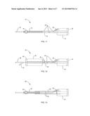 METHODS FOR TYING, CLEANING AND RE-CEMENTING MASONRY USING PORT ANCHORS diagram and image