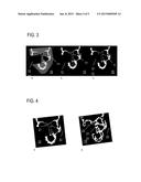 PROCESSING MODEL DATA REPRESENTING A BIOLOGICAL BODY SECTION HAVING A     DEFECT PORTION diagram and image