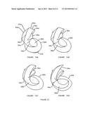 Rotor Mechanism diagram and image