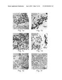 Disease treatment via developing non-syngeneic graft transplantation diagram and image