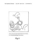 ANTI-IGF ANTIBODIES diagram and image