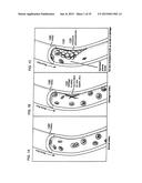 METHODS AND COMPOSITIONS TO TREAT MYOCARDIAL CONDITIONS diagram and image