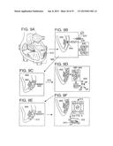 METHODS AND COMPOSITIONS TO TREAT MYOCARDIAL CONDITIONS diagram and image