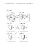 METHODS AND COMPOSITIONS TO TREAT MYOCARDIAL CONDITIONS diagram and image