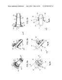 NEEDLE GUARD, ASSEMBLY AND METHOD OF IMPLANTING A HEART ASSIST SYSTEM diagram and image