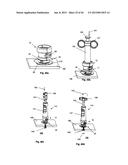 NEEDLE GUARD, ASSEMBLY AND METHOD OF IMPLANTING A HEART ASSIST SYSTEM diagram and image