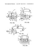 NEEDLE GUARD, ASSEMBLY AND METHOD OF IMPLANTING A HEART ASSIST SYSTEM diagram and image