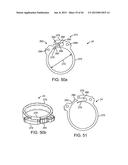 NEEDLE GUARD, ASSEMBLY AND METHOD OF IMPLANTING A HEART ASSIST SYSTEM diagram and image