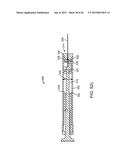 NEEDLE GUARD, ASSEMBLY AND METHOD OF IMPLANTING A HEART ASSIST SYSTEM diagram and image