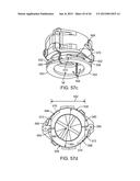 NEEDLE GUARD, ASSEMBLY AND METHOD OF IMPLANTING A HEART ASSIST SYSTEM diagram and image