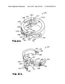 NEEDLE GUARD, ASSEMBLY AND METHOD OF IMPLANTING A HEART ASSIST SYSTEM diagram and image