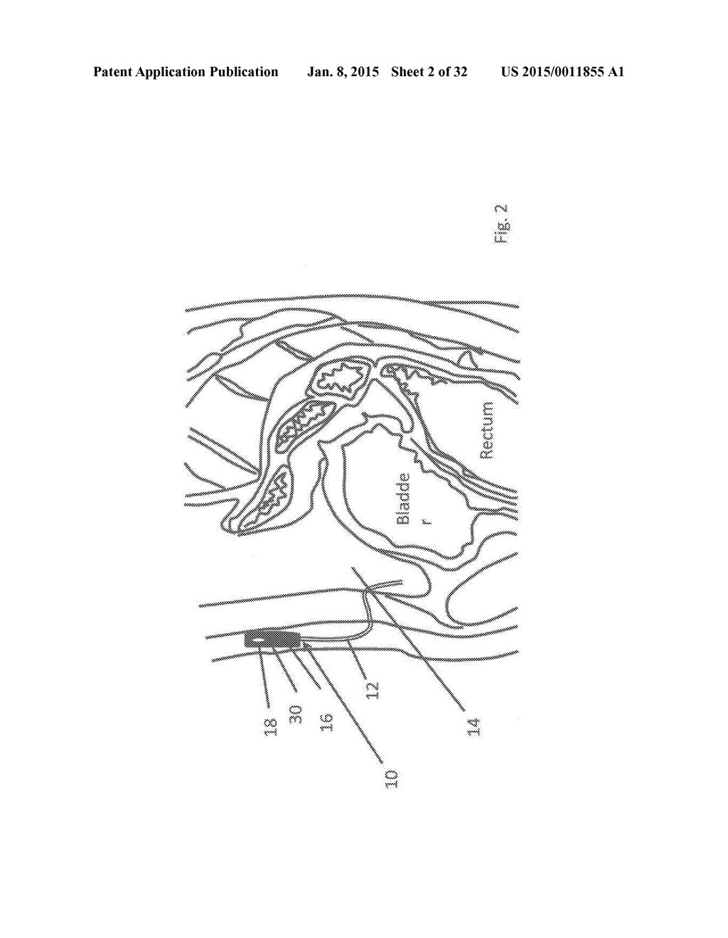 METHODS AND DEVICES FOR THE DIAGNOSIS AND TREATMENT OF DIABETES - diagram, schematic, and image 03