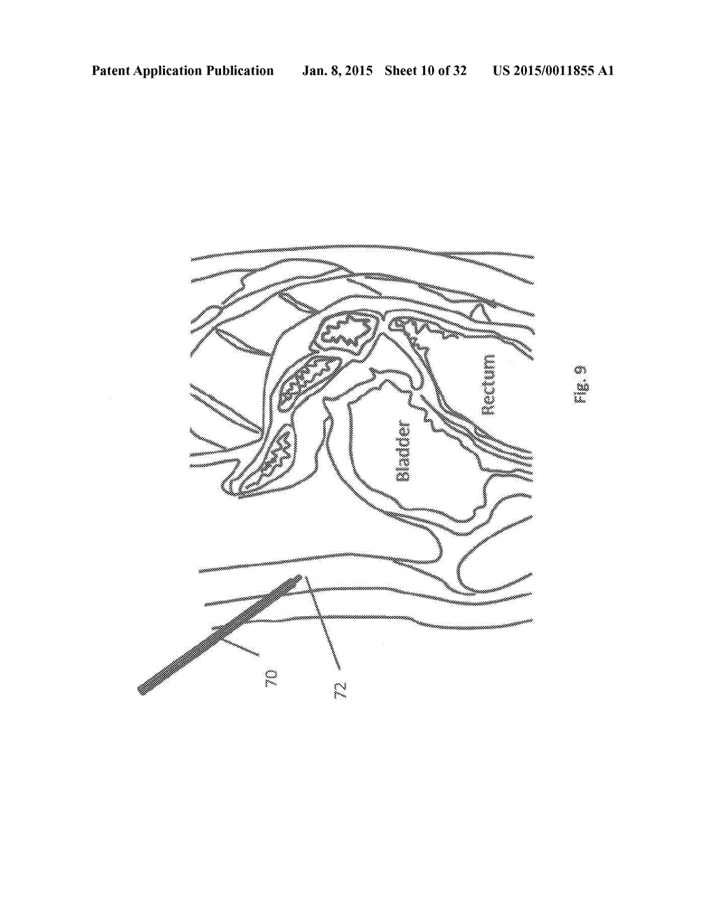 METHODS AND DEVICES FOR THE DIAGNOSIS AND TREATMENT OF DIABETES - diagram, schematic, and image 11