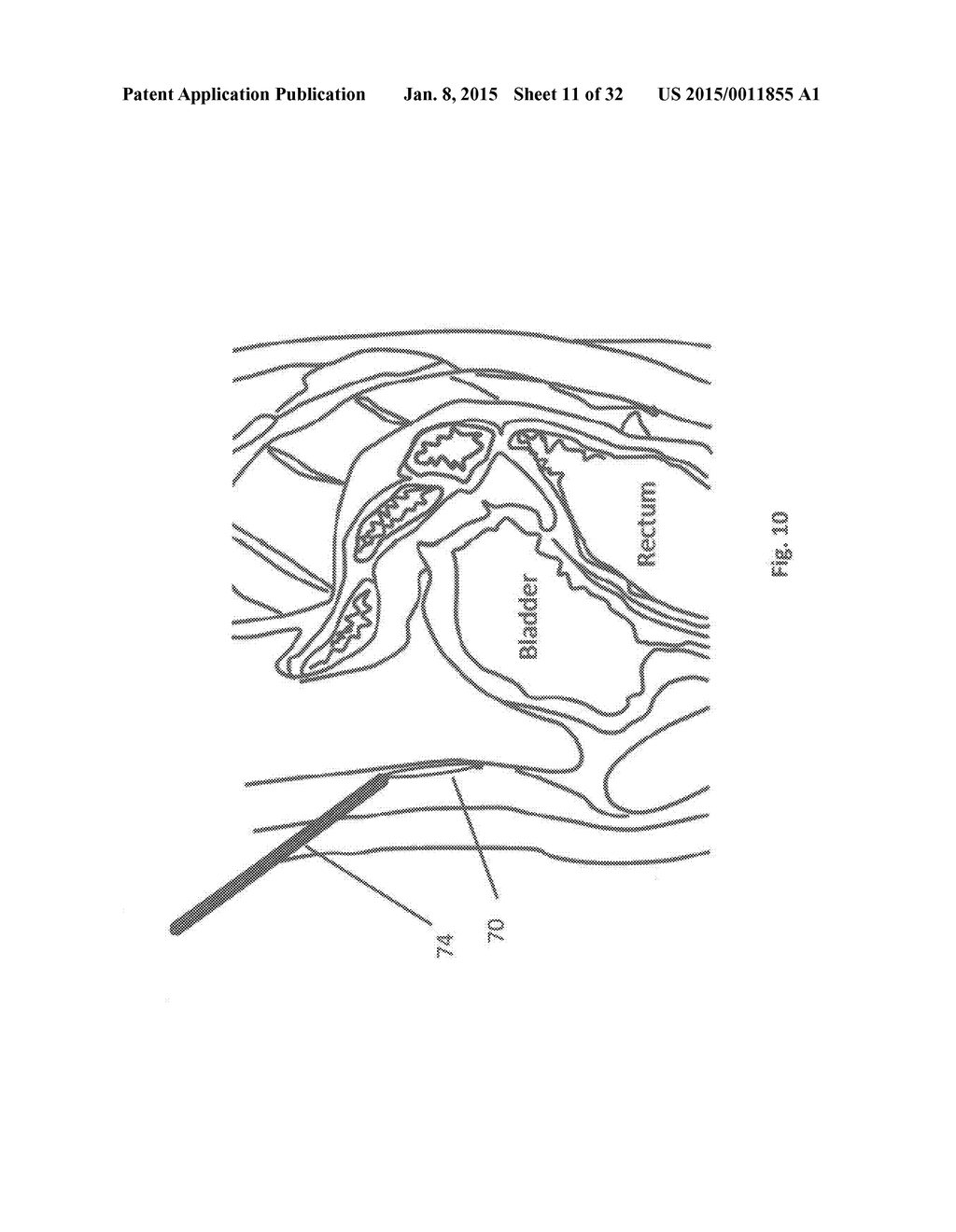 METHODS AND DEVICES FOR THE DIAGNOSIS AND TREATMENT OF DIABETES - diagram, schematic, and image 12