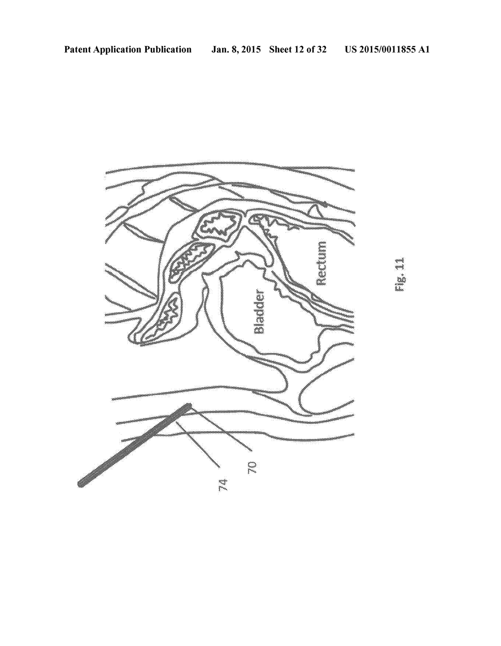 METHODS AND DEVICES FOR THE DIAGNOSIS AND TREATMENT OF DIABETES - diagram, schematic, and image 13