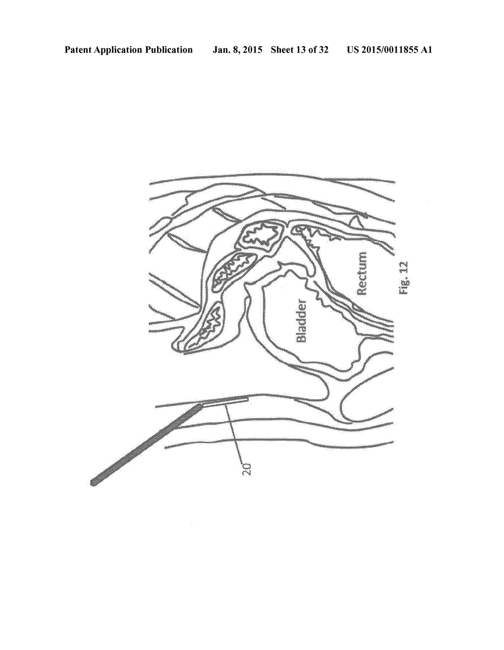 METHODS AND DEVICES FOR THE DIAGNOSIS AND TREATMENT OF DIABETES - diagram, schematic, and image 14