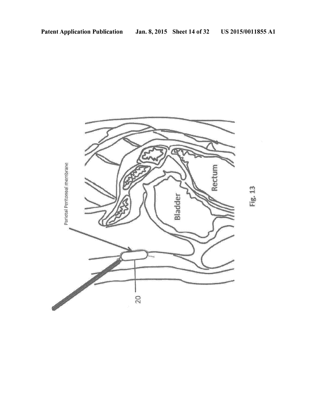 METHODS AND DEVICES FOR THE DIAGNOSIS AND TREATMENT OF DIABETES - diagram, schematic, and image 15